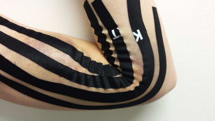 taping technique to reduce edema swelling bruising
